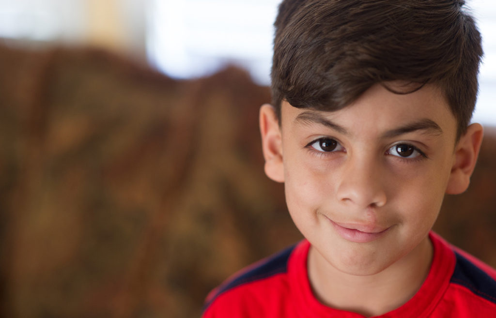 Cleft Lip: Luis's Story - New Orleans Craniofacial